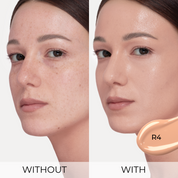 R4 - Light Medium Rosy