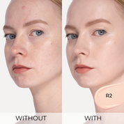 R2 - Fair Light Rosy